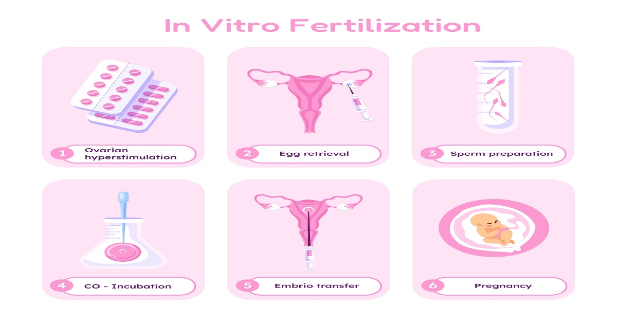 Traditional IVF vs Mini IVF