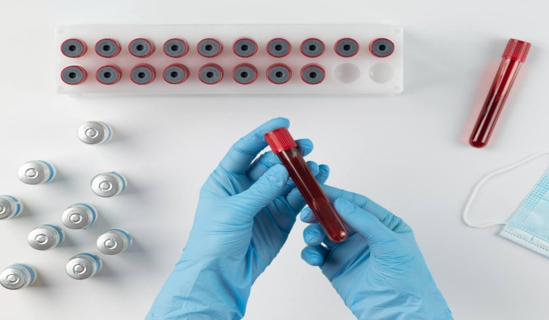Semen Analysis & Fertility Blood Tests for Male