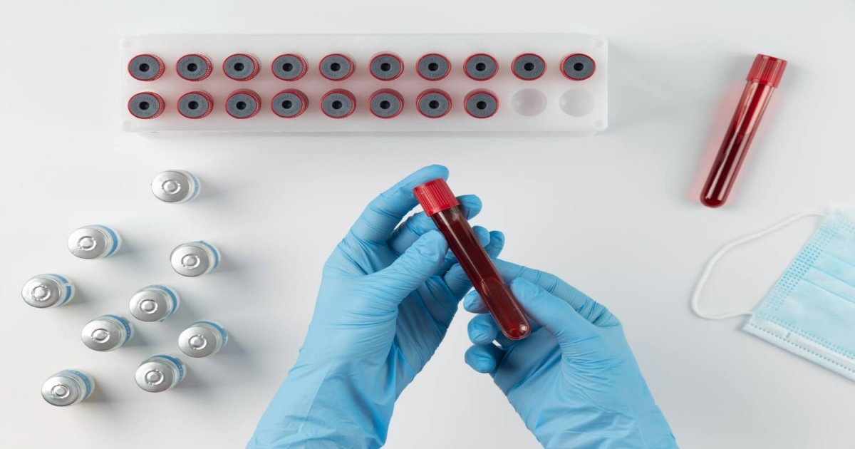 Semen Analysis & Fertility Blood Tests for Male