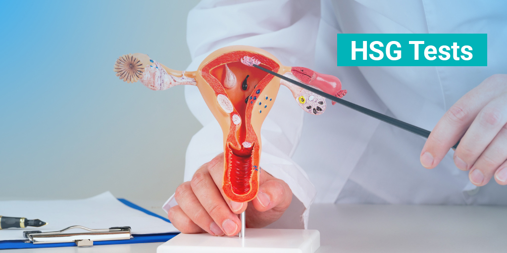 HSG Tests in Noida