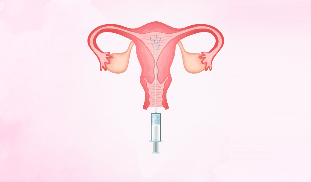 iui7