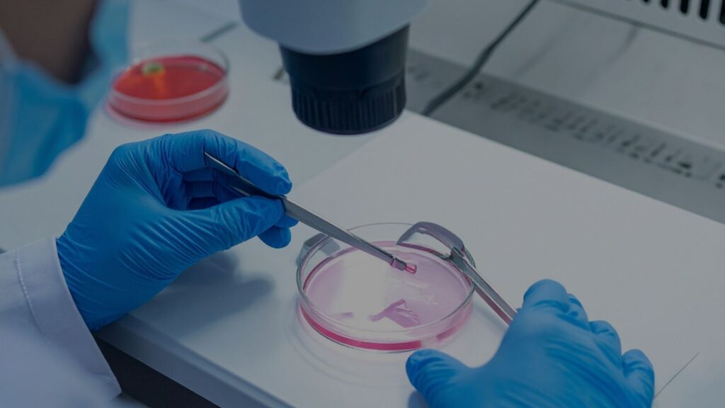 Donor Sperm IVF Treatment
